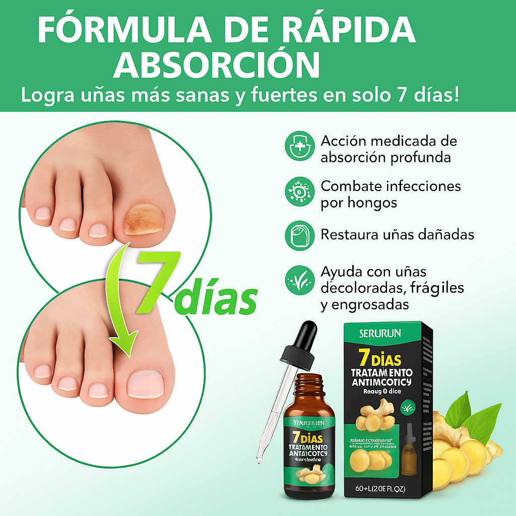Aceite Natural MycoStop™ – Uñas listas para playa y piscina: elimina hongos desde la raíz y borra el amarillo (Con remedios naturales + Envío GRATIS)