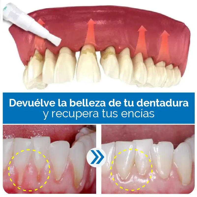 1 + 1 GRATIS | LAPIZ WHITE™ - Consigue que envidien tu sonrisa desde la primera aplicación (Ingredientes naturales)