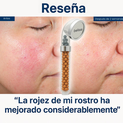 Ducha Heikel3X™ - La única ducha iónica del mercado con presión real y filtrado natural. (Rosca universal e incluye hoy Envío GRATIS) *Cada filtro dura más de 6 meses