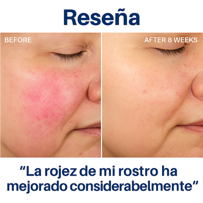 2 x HYDROLUXE™ - Elimina el cloro y la cal de tu ducha. Y aumenta la presión ahorrando agua en cada uso. Incluye 2 filtros extras. (+Envío GRATIS)