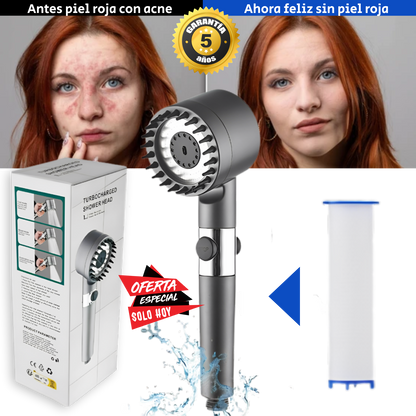 ULTRASHOWER ™ - El único cabezal de ducha que gracias a su filtro interno previene  y elimina casi al 100% todo tipo de rojeces en la piel (Incluye 3 tipos de presión).