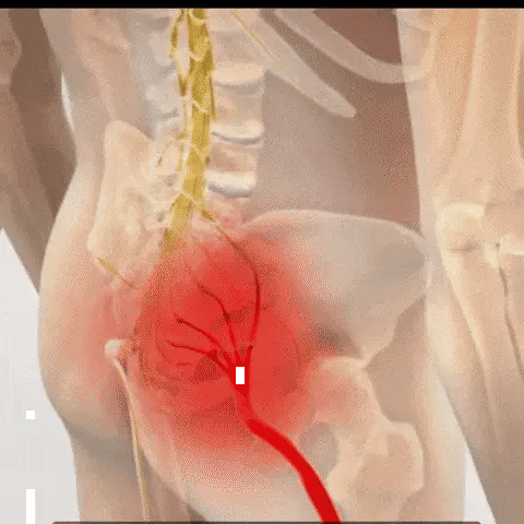 FlexiBack™ – El único cinturón cómodo y discreto que te permite volver a disfrutar de horas de pie sin dolor lumbar (Hoy GRATIS Almohada Ortopédica valorada en 29 euros).